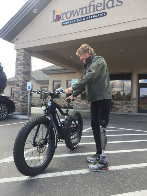 a man with prosthetic leg standing next to a bicycle