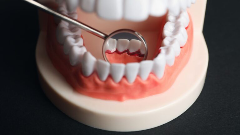 a close up of a model of teeth