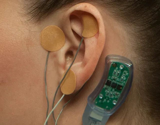 a close-up of a person's ear with electrodes