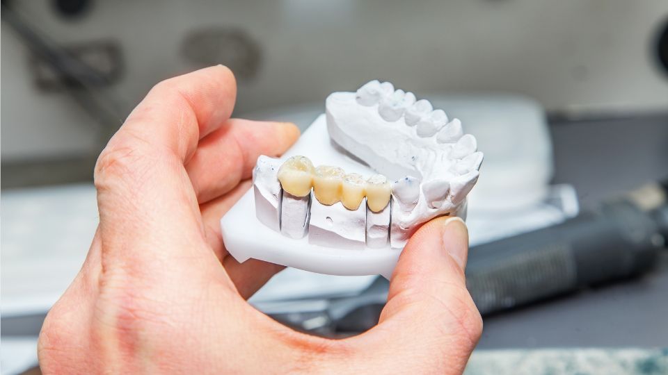 a hand holding a model of teeth