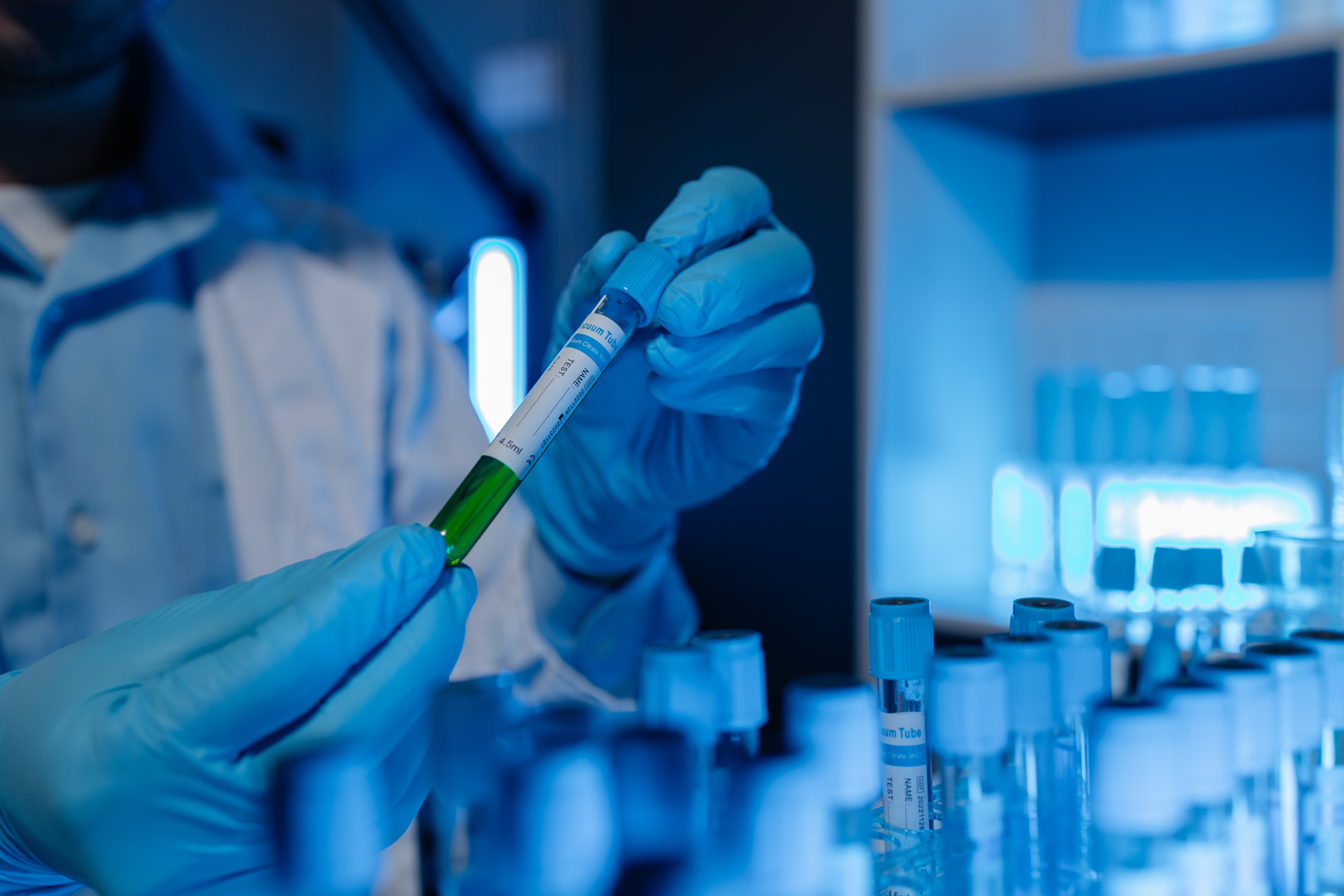 a person holding a tube with a green liquid