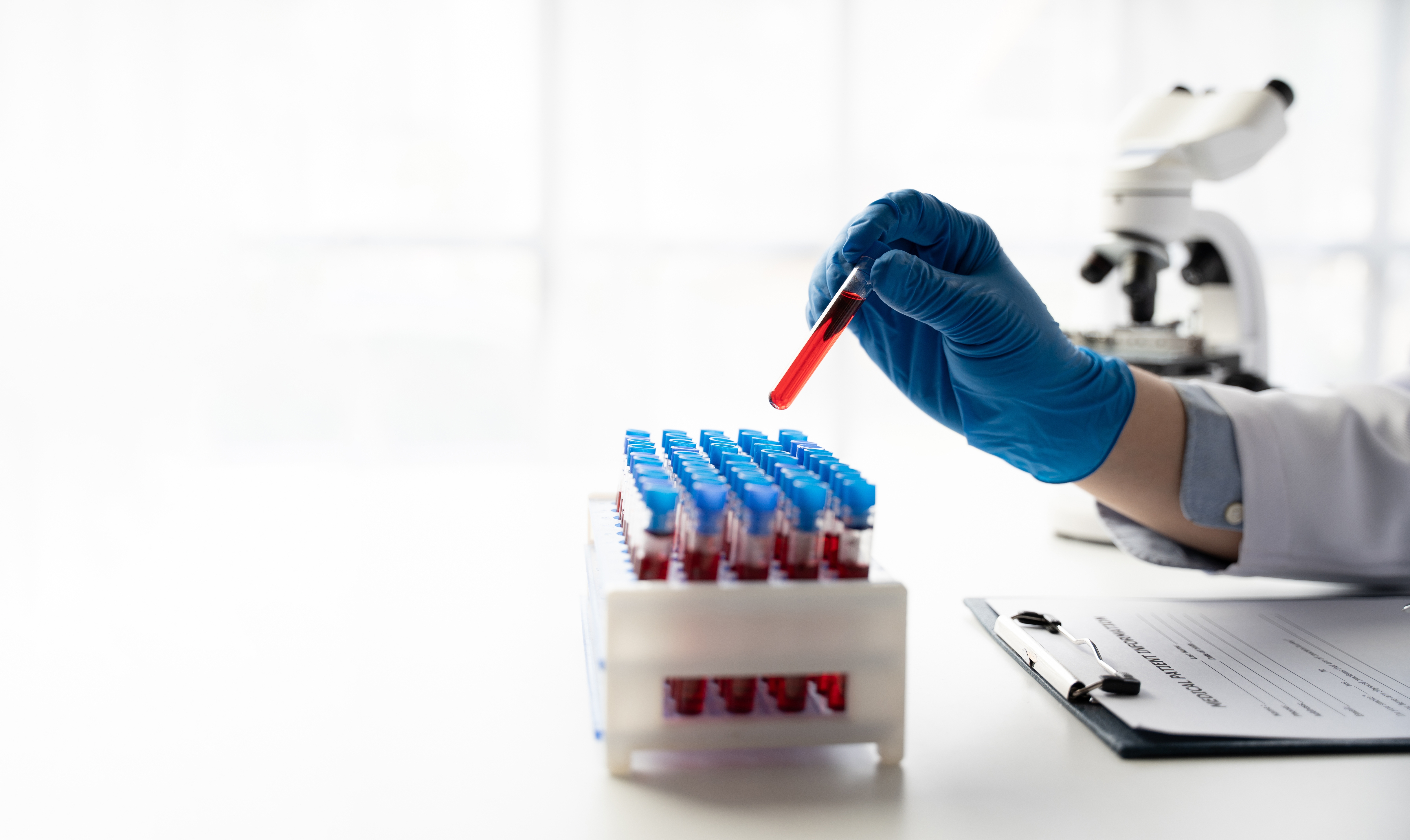 a person holding a test tube with a red liquid in it