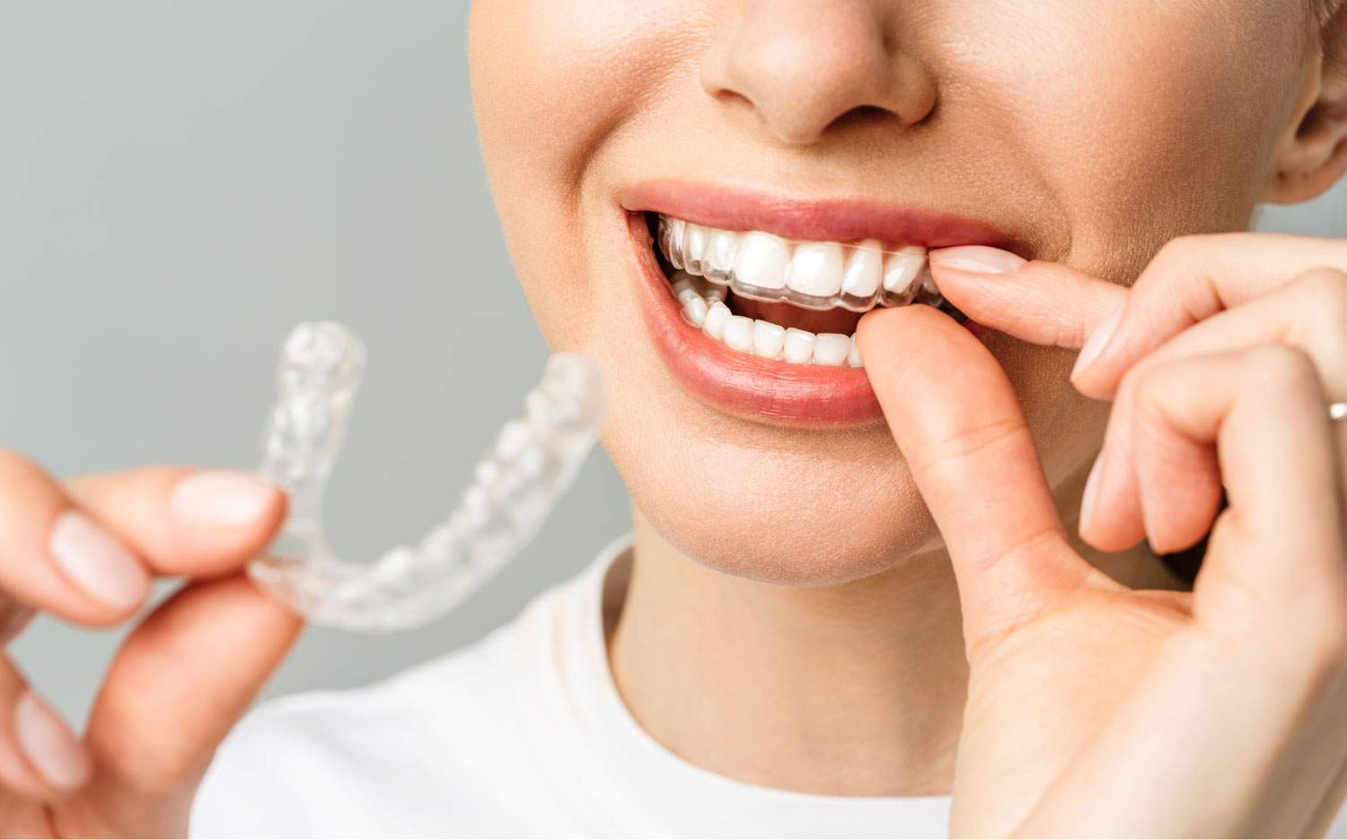 a woman smiling and holding a clear plastic retainer