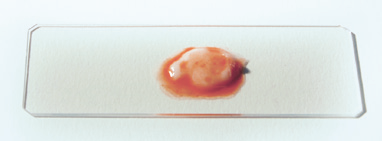 a blood blob on a white surface