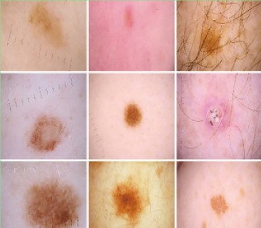 a collage of skin diseases