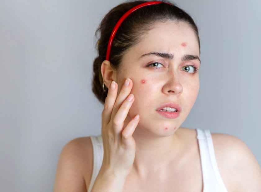 a woman with a red headband touching her face