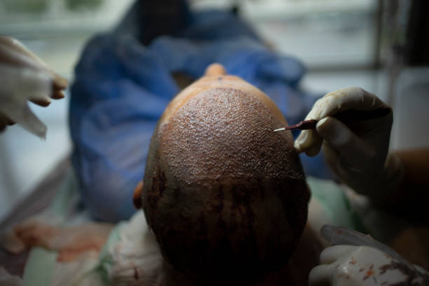 a person with a scalpel on their head