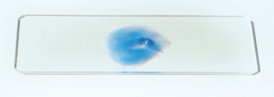 a blue blob of a cell