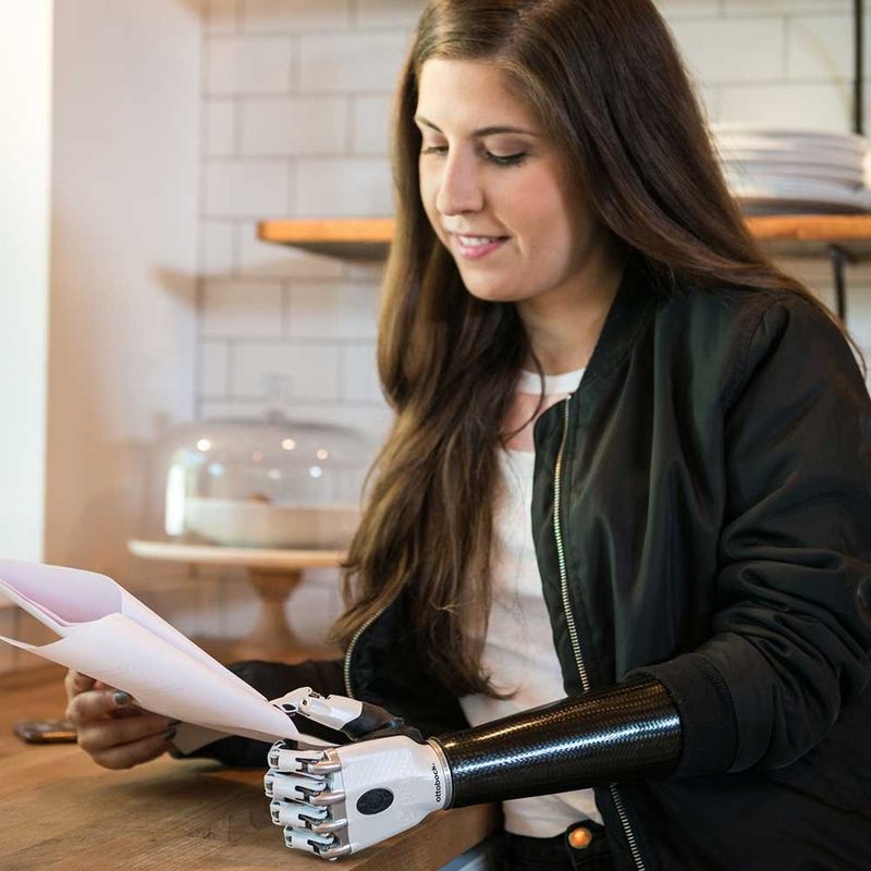 a woman with a prosthetic arm